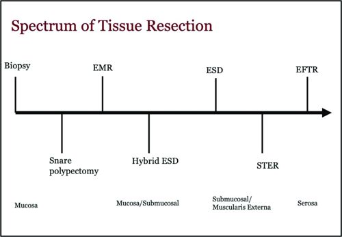 168897_Figure 1_web.jpg